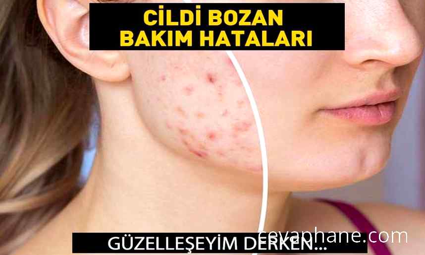 Cilt Bakımında Yapılan Hatalar: Sivilcelere Davetiye Çıkaran Yanlışlar